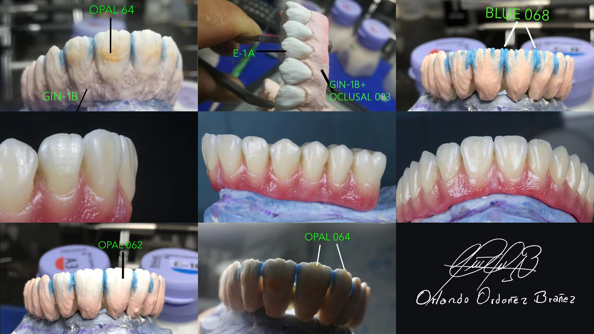 dental lab porcelain ceramic effect luster
