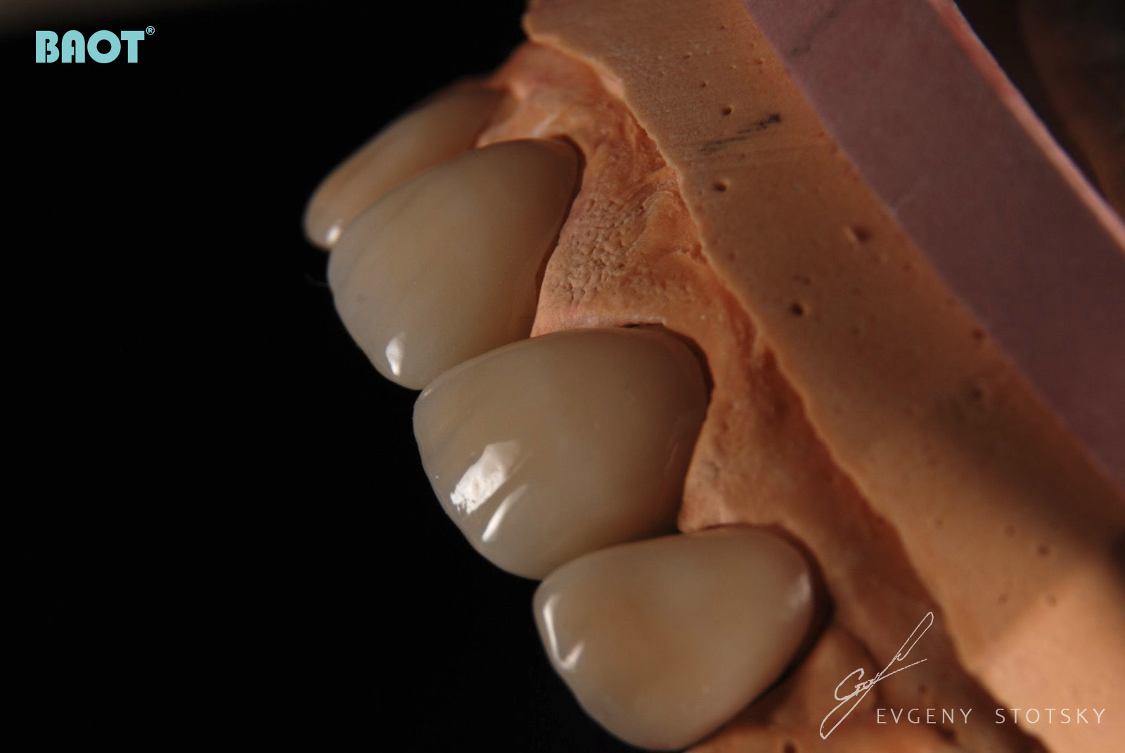 Polvo de material cerámico dental para restauración
