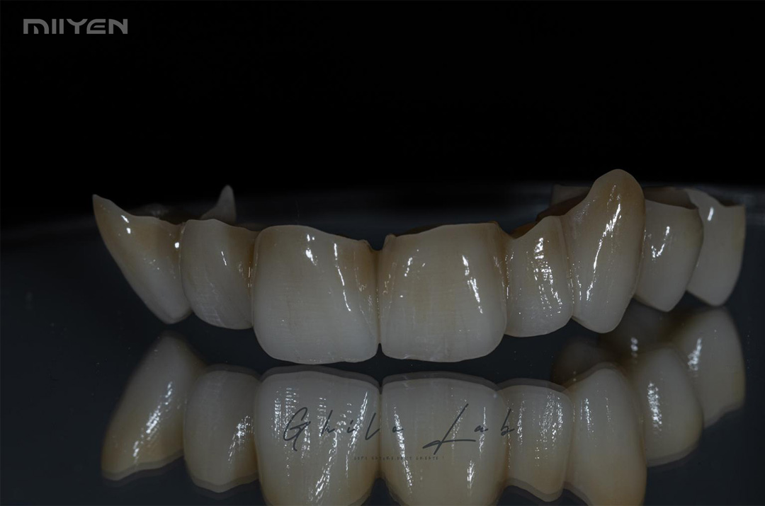 MIIYEN circonio 3D Pro para odontología