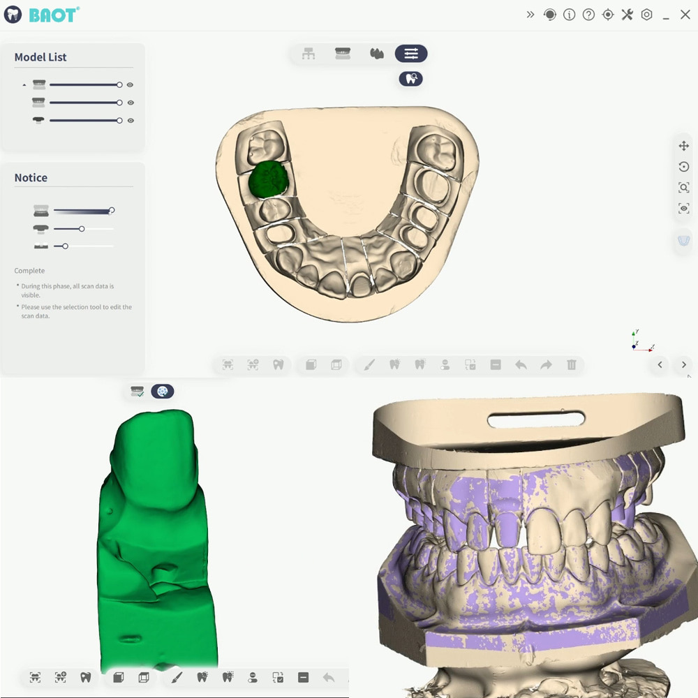 Máquina de escáner dental 3D Escaneo de mandíbula inferior