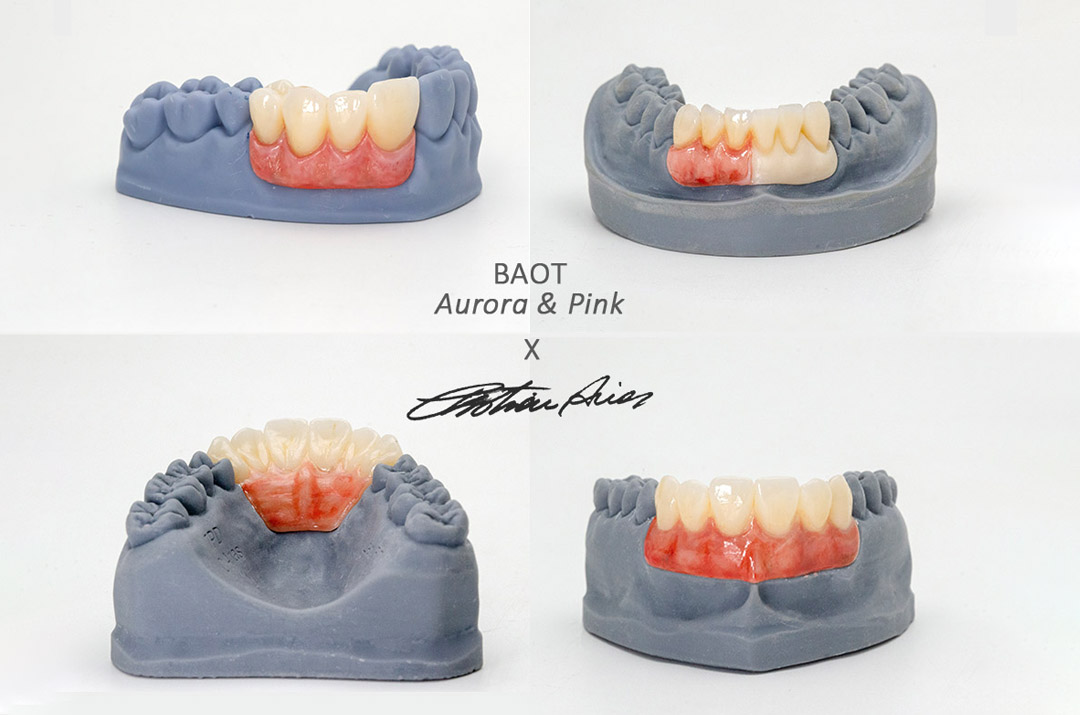 Puntas de glaseado con tinte dental BAOT Aurora