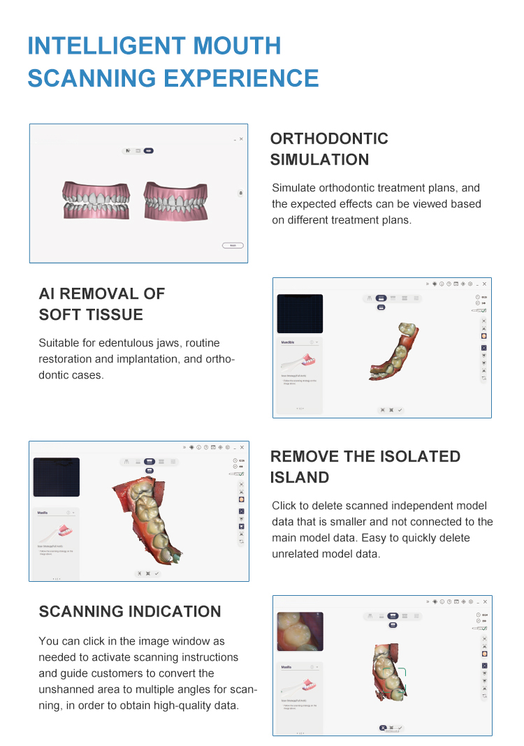 High Precision Dental CAD CAM Scanner