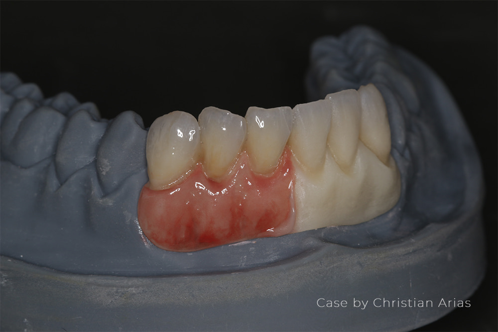 Dental Stain Glaze Gingiva Kit for Lab