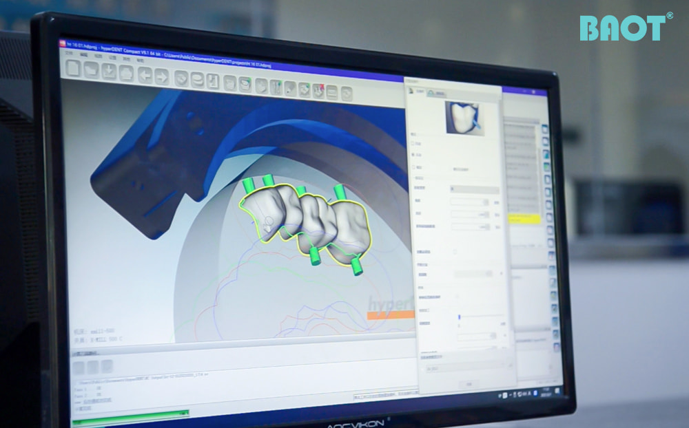 El papel de los bloques de zirconia en el futuro de la odontología digital